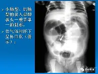 Ning势不可挡结果意外(不可饶恕剧情详细介绍)